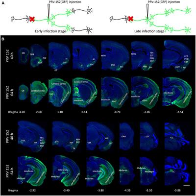 Whole-Brain Mapping of the Inputs and Outputs of the Medial Part of the Olfactory Tubercle